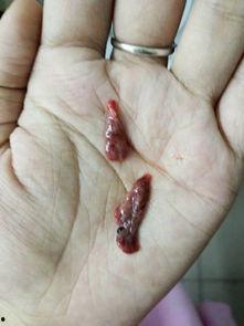 流产可以吃籽瓜嘛,籽瓜的营养益处与适宜食用指南